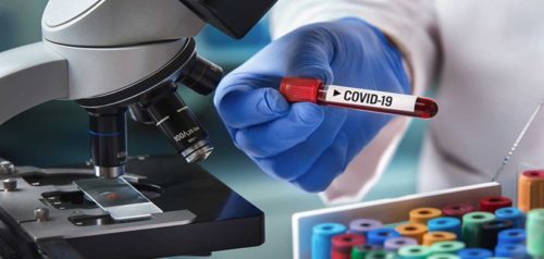 गैडाकोटका स्वास्थ्यकर्मीको स्वाव परिक्षणको रिपोर्ट नेगेटिभ