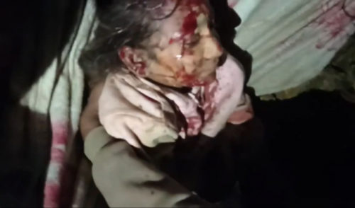 बैतडीको खोड्पेमा बस खस्यो, ८ जनाको मृत्यु, २९ भन्दा बढी घाइते