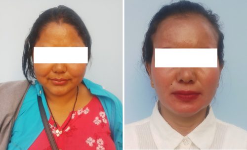 बलात्कारको आरोप लगाउँदै रकम असुल्ने धन्दा चलाउने दुई जना महिला पक्राउ