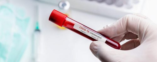 नवलपुरमा थप ८२ जनामा कोरोना संक्रमण