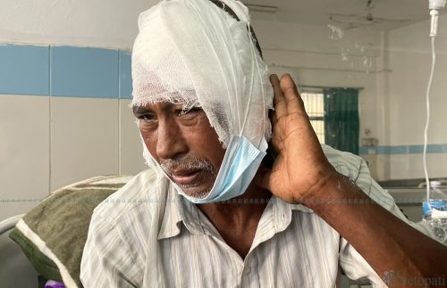 दुई वर्ष पहिले गोहीबाट बचेका टकबहादुर यसपटक बाघलाई लौराले हानेर ज्यान जोगाए