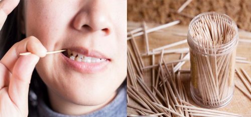 अढाई करोडका सिन्काले दाँत कोट्याउँछन् नेपाली !