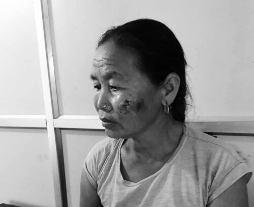लोकाहा खोला किनारमा बाख्रा चराउदैँ गरेकी महिला गैँडाको आक्रमण बाट घाईते